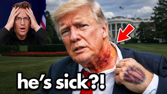 maxresdefault-33 Internet in SHOCK at ‘Bloody’ Trump Neck…